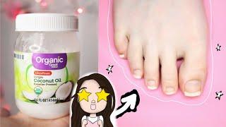 How To Grow Your Toenails Long FAST with coconut oil