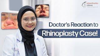 HIDUNGNYA KENAPA? Reaksi Dokter Bedah Liat Kasus Hidung‼️