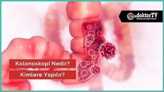 Kolonoskopi Nasıl Yapılır?  Kolonoskopi Nedir ve Kimlere Yapılır?  Prof.  Dr. Çetin Karaca