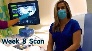 8 Week Scan & no heartbeat  What to expect with Silentmissed miscarriage & early symptoms Vlog 13