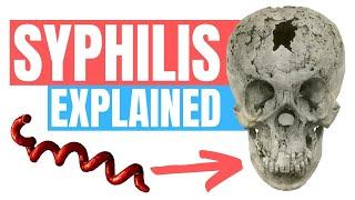 Do you have Syphilis? - Symptoms Tips and Treatment - Doctor Explains