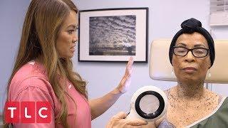 Removing Moles with Liquid Nitrogen  Dr. Pimple Popper