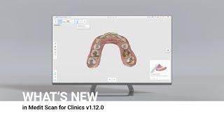 Whats new in Medit Scan for Clinics v1.12.0