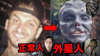 【恐怖故事】35歲男子瘋狂做人體改造 黑色外星人，殘忍換臉手術要切鼻子及割耳朵！原來他前世是蜥蜴人？