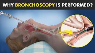 Bronchoscopy - Procedure To View Inside Of Air Ways