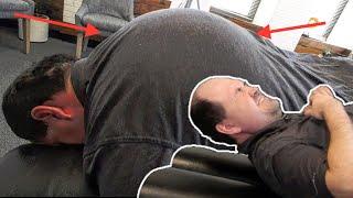 Man CANT Move His NECK & Has SEVERE HYPERKYPHOSIS *Part 2*