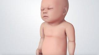 Infant Distress Warning Signs Grunting Baby Sound