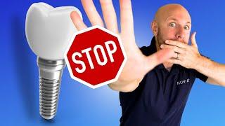 Dont Get Dental Implants WITHOUT Knowing These 5 Things