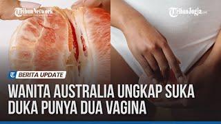 Wanita Australia Ungkap Suka Duka Punya Dua Vagina