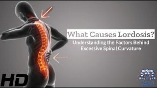 Unlocking Lordosis The Factors Behind Excessive Spinal Curvature