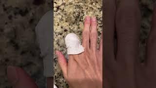You MUST DO THIS if you cut off your finger - Save your finger while you can