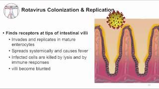 Acute GI Watery diarrhea and viruses