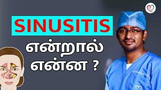 SINUSITIS என்றால் என்ன ?  SINUSITIS in Tamil  Dr. Manoj ENT Speciality Centre  Trichy