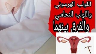 اللولب النحاسي واللولب الهرموني احسن وسائل منع الحمل