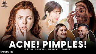 Tips to tackle ACNE PIMPLES  HONEST TIPS to improve your skin  Assamese PODCAST - 102