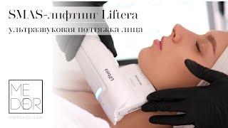 Ультразвуковой SMAS лифтинг LIFTERA