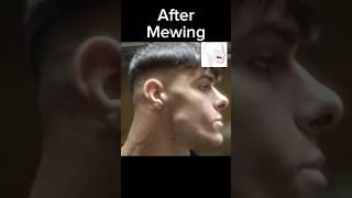 #mewing results