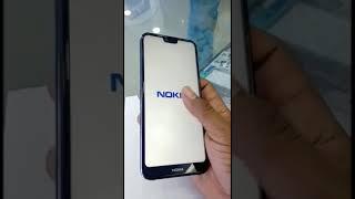 NOKI 7.1 full notch display