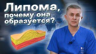 Что такое липома почему она образуется?