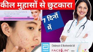 Clindamycin and nicotinamide gel  Faceclin gel uses