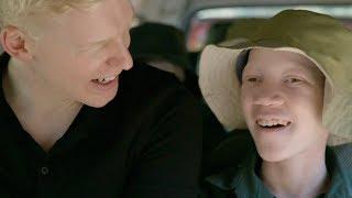 Born Too White - Being Albino in East Africa  Medical Documentary  Reel Truth. Science