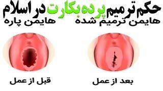 حکم ترمیم پرده بکارت در اسلام