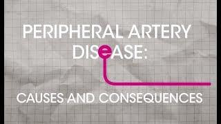 What is Peripheral Artery Disease PAD Causes and Consequences