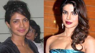 Bollywood Actresses who underwent SKIN LIGHTENING Surgery