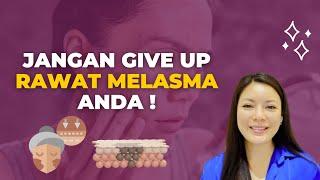 Beauty Tips  Jangan Give Up Rawat Melasma Anda