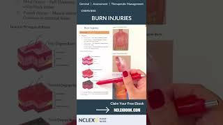 Burn Injuries Overview for Nursing Students #shorts #NCLEX #nursingschool #nursing #nclexprep