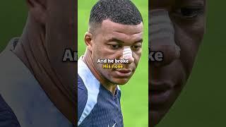 Mbappe Will Wear the Funniest Mask in Euro 2024