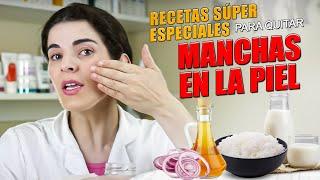 Elimina las MANCHAS DE LA PIEL incluso el MELASMA - Receta casera