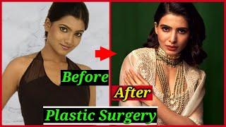 Shocking Plastic Surgery of South Indian Actresses  Samantha Akkineni Kajal Aggarwal Anushka