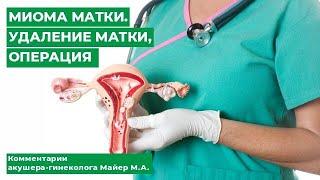 Миома матки. Удаление матки операция. Комментарии акушера-гинеколога Майер М.А.