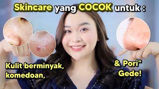 Skincare yang COCOK untuk Kulit Berminyak Komedoan & Pori Gede ⭐️