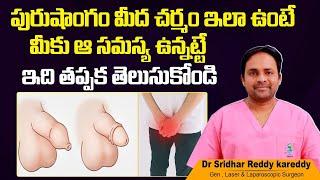 Best Treatment for Paraphimosis  KSR Stapler Circumcision in Telugu  Treatment Range Hospital