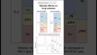 Obesity effects on lung volumes