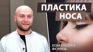 Ринопластика — что нужно знать пластика носа изменение формы