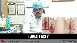 Information On Labiaplasty Vagina Tightening Surat Ahmedabad Gujarat Mumbai Pune Maharashtra