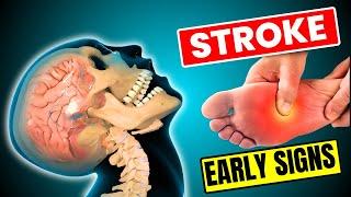 9 Warning Signs of Stroke One Month Before - Shocking Symptoms Revealed