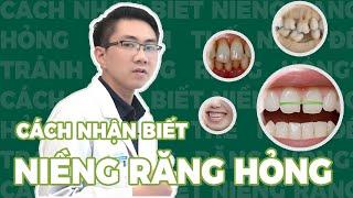 Cách Nhận Biết Niềng Răng Hỏng  Làm Thế Nào Để Tránh Niềng Răng Hỏng  Bác Sĩ Nam Bùi Vinalign