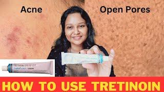 Tretinoin Cream  How to use TRETINOIN  0.025 cream #acneproneskin #skincare #acne #viralproducts