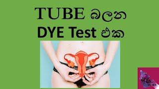 TUBE බලන DYE Test එක Tube balana dye test eka Hysterosalpingogram  HSG ටියුබ් බලන ඩයි ටෙස්ට් එක.