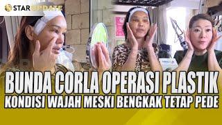 BUNDA CORLA OPERASI PLASTIK BEGINI KONDISI WAJAH MESKI BENGKAK TETAP PEDE - STAR UPDATE