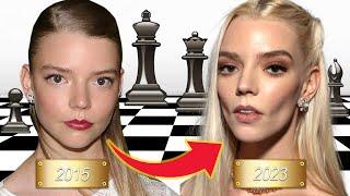 The Extensive Plastic Surgeries of Anya Taylor Joy So Much So Young