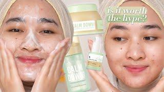 Somethinc Calm Down Review on acne prone sensitive skin  Kiara Leswara