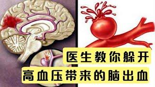 脑血管“爆了”，脑出血非死即残！医生提醒：主要原因是高血压！