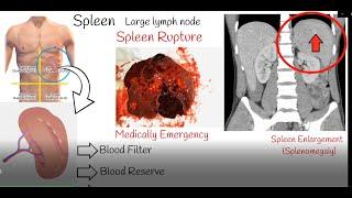 Spleen pain Spleen enlargement and Spleen rupture. Causes and treatment