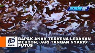 Pacitan - Bapak Anak Terkena Ledakan Mercon Jari Tangan Nyaris Putus