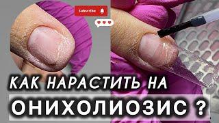 ОНИХОЛИЗИС КАК НАРАСТИТЬ НОГТИ? ДИП СИСТЕМА #подология #подолог #обучениеподологии #аленалаврентьева